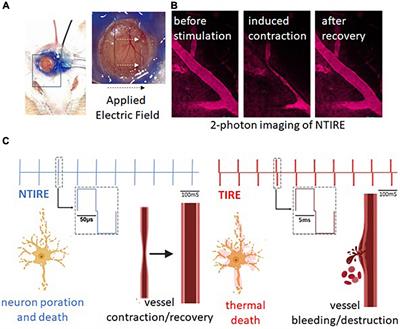 Non-thermal Electroporation Ablation of Epileptogenic Zones Stops Seizures in Mice While Providing Reduced Vascular Damage and Accelerated Tissue Recovery